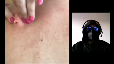 Pimple Paradise: Where Imperfections Disappear!