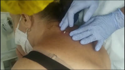 Explosive Pore Purging: Clear Skin Ahead!