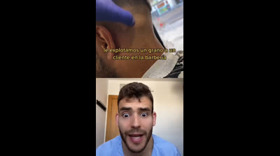 Bursting Pores: The Journey to Flawless Skin!