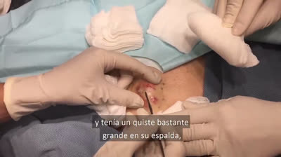 Pore Perfection: The Journey to Clear Skin Begins Here!