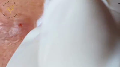 Popping Party: A Blast of Satisfaction!