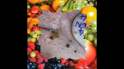 The Great Pimple Purge: Where Imperfections Go to Die!