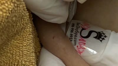 Bursting Blackheads: The Ultimate Cleansing Experience!