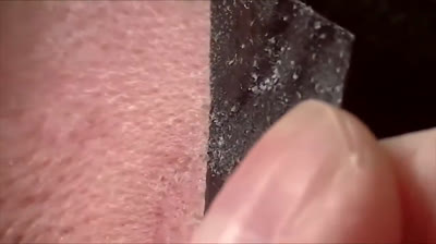 Bursting Blackhead Bash: A Blast of Cleansing!