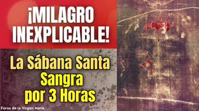 ¡Milagro Desafía la Comprensión Humana! La Sábana Santa de Turín sangra por 3 horas